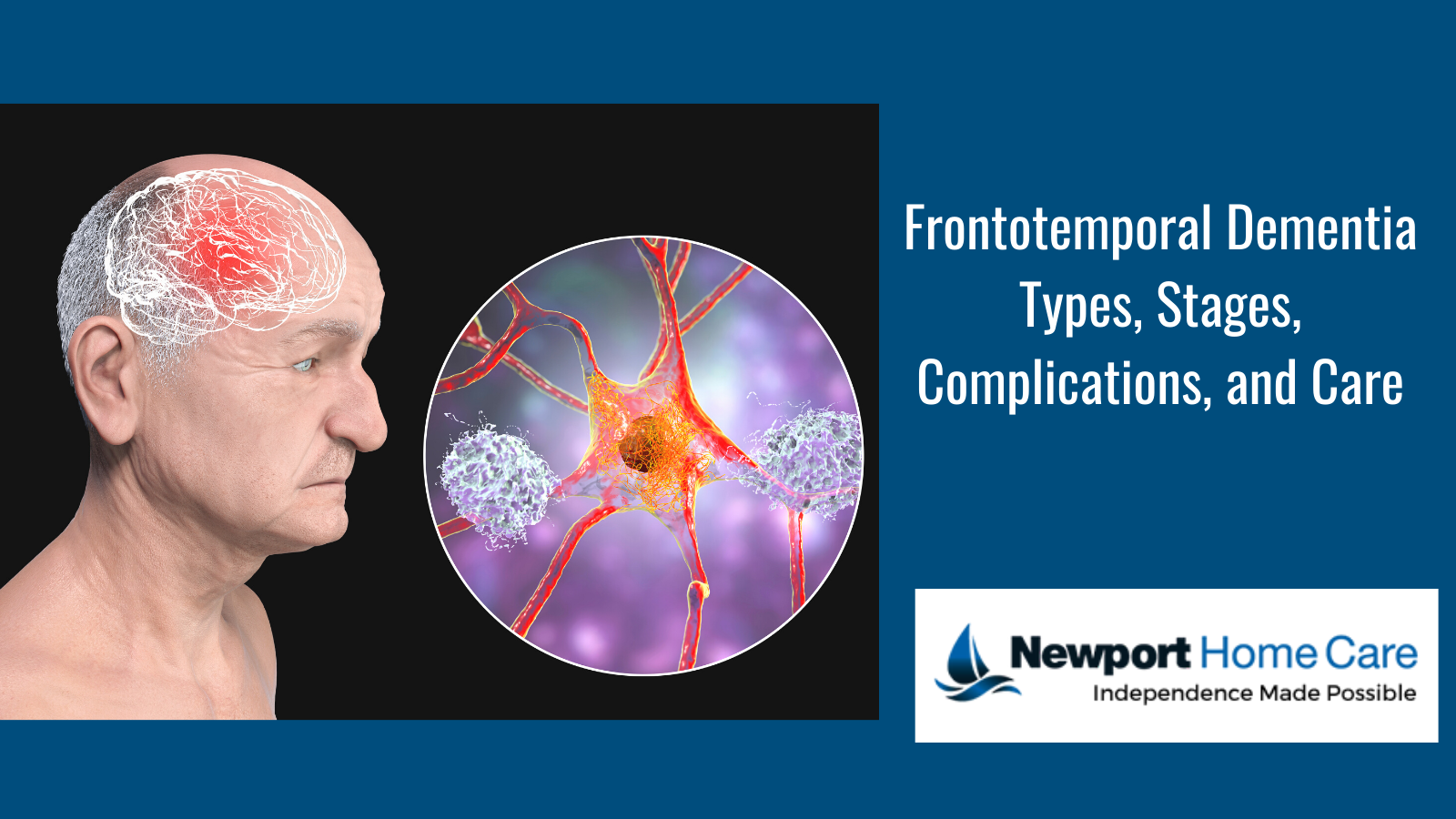 Frontotemporal Dementia: Types, Stages, Complications, and Care
